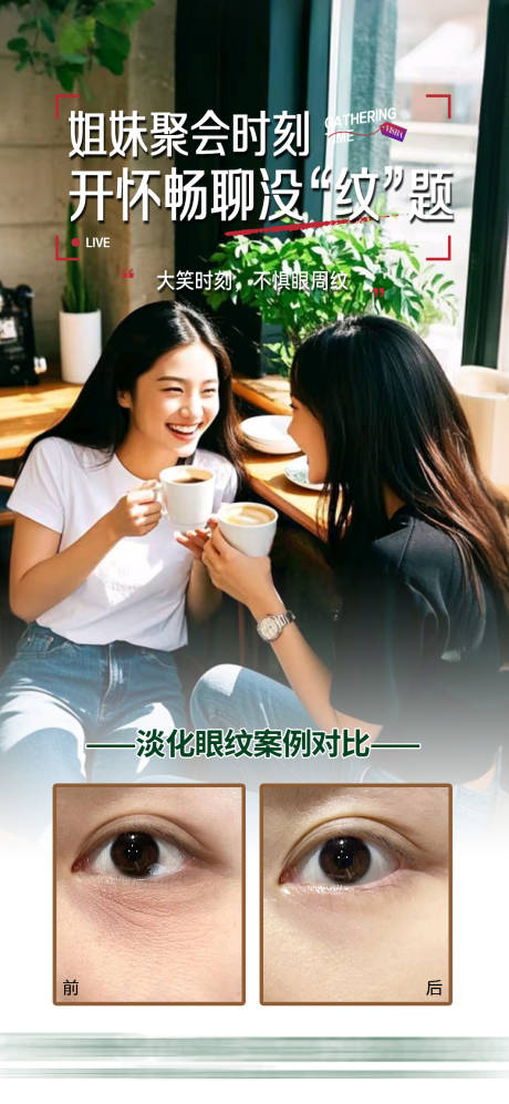 源文件下载【眼周皱纹】编号：20870028998503463