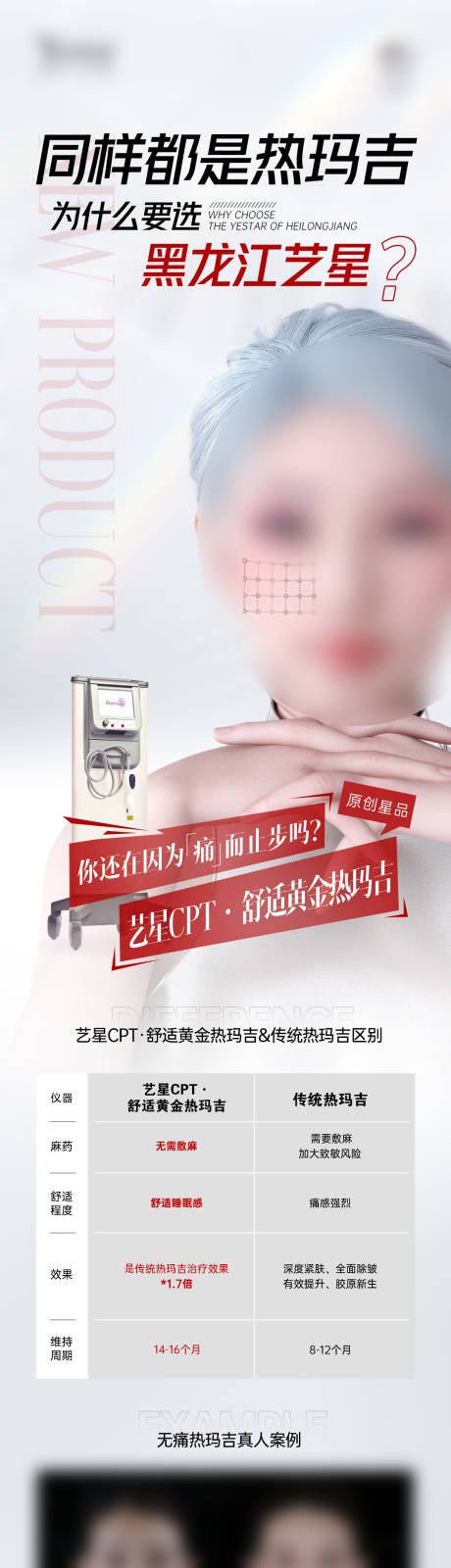 源文件下载【医美仪器案例对比热玛吉长图】编号：88670029003787812