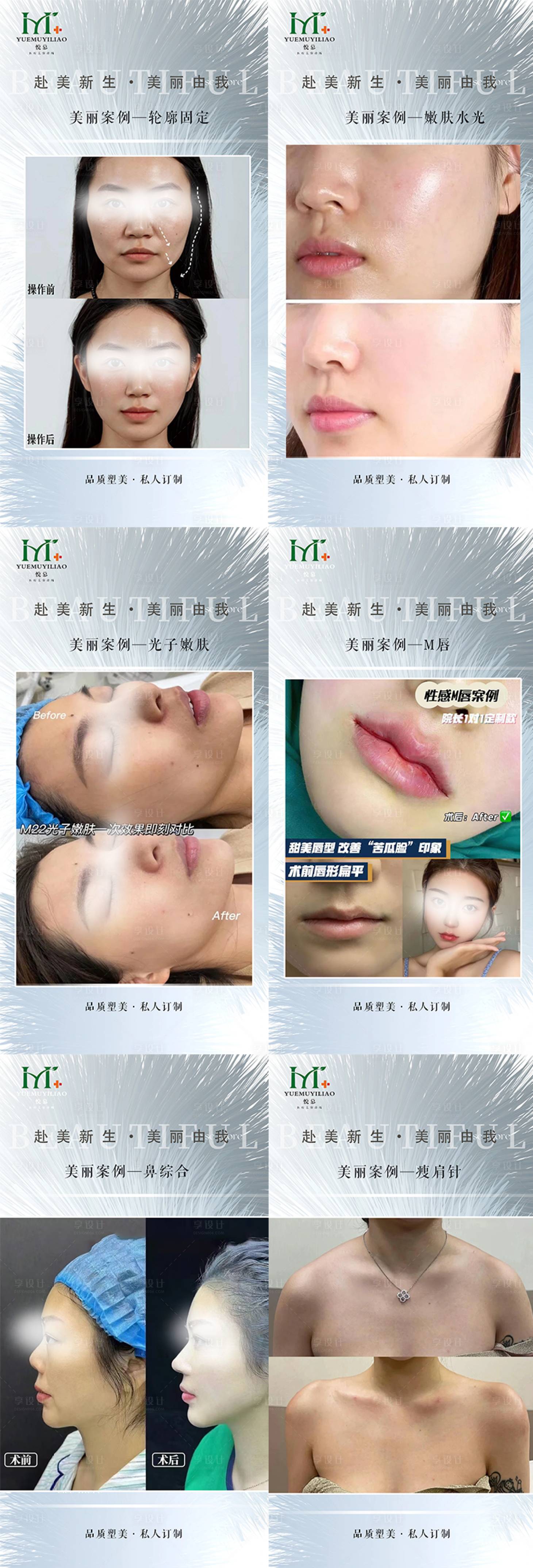源文件下載【享設(shè)計】搜索編號：52610029494847295【醫(yī)美案例】
