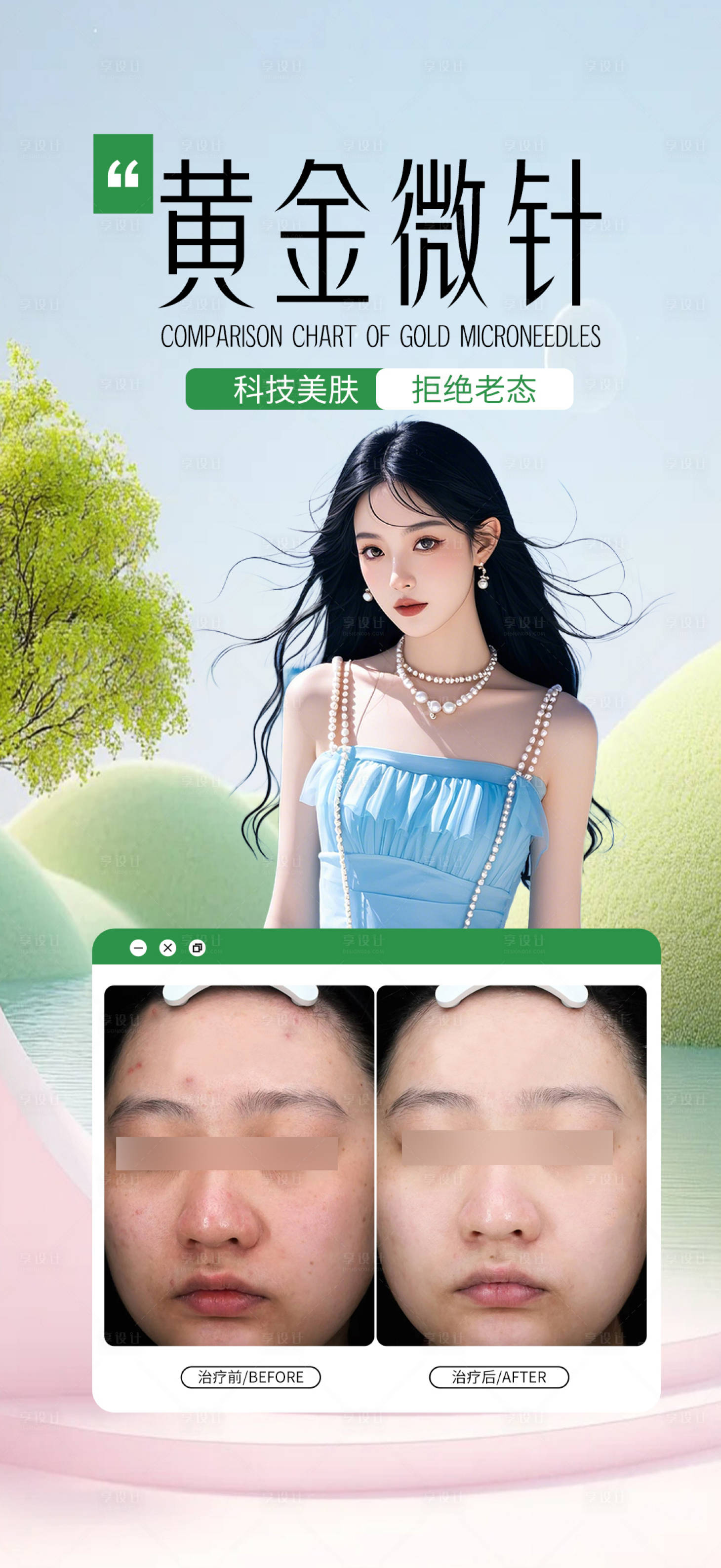源文件下載【享設計】搜索編號：89730029734866247【黃金微針皮膚案例】