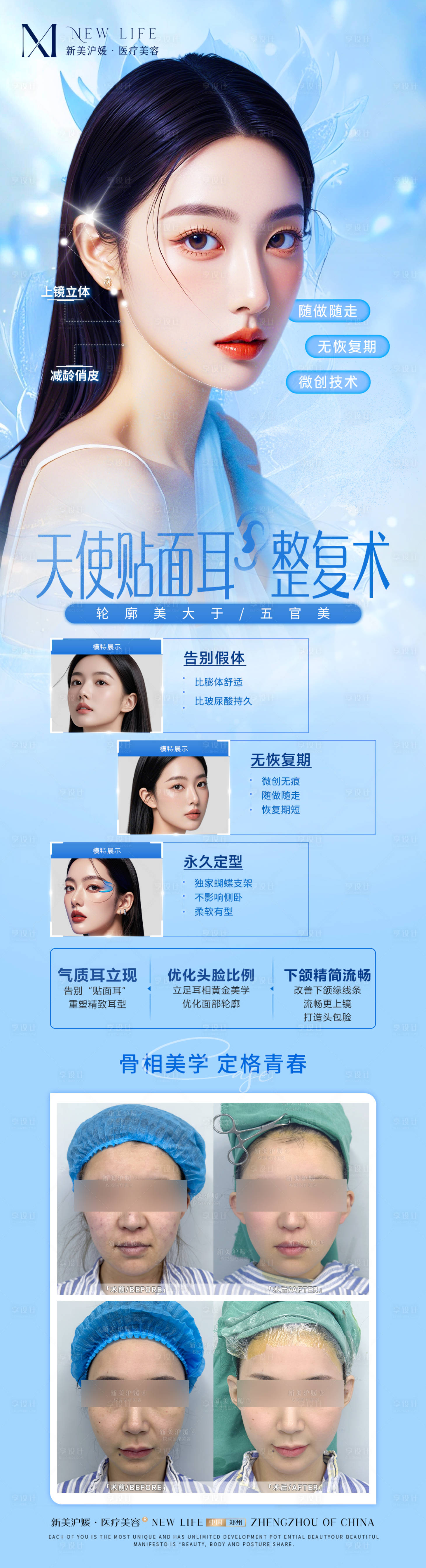 源文件下载【医美埋线精灵耳长图海报】编号：89890029587159798