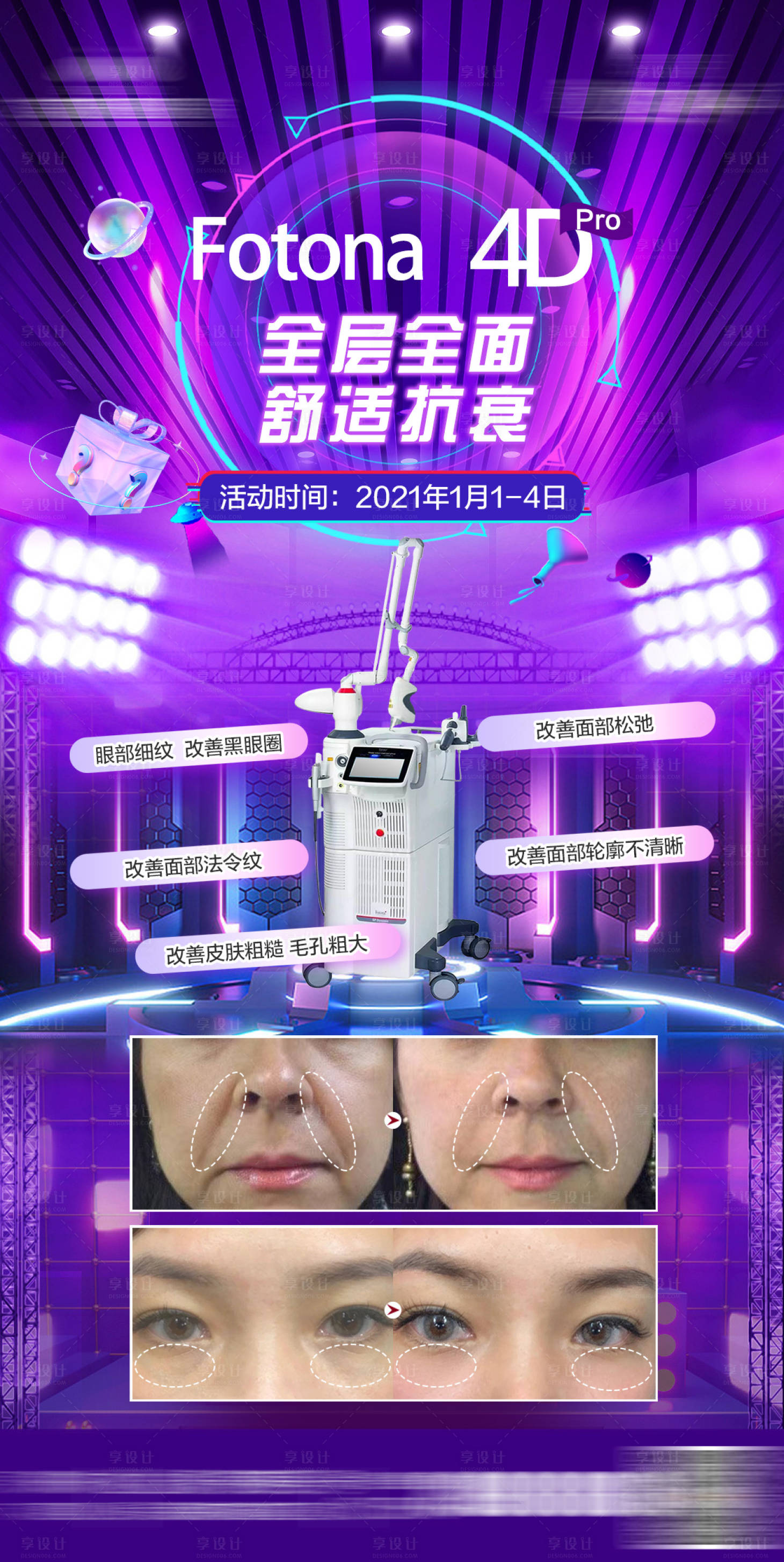 源文件下載【享設計】搜索編號：96060029570401661【醫美Fotona4D儀器海報】