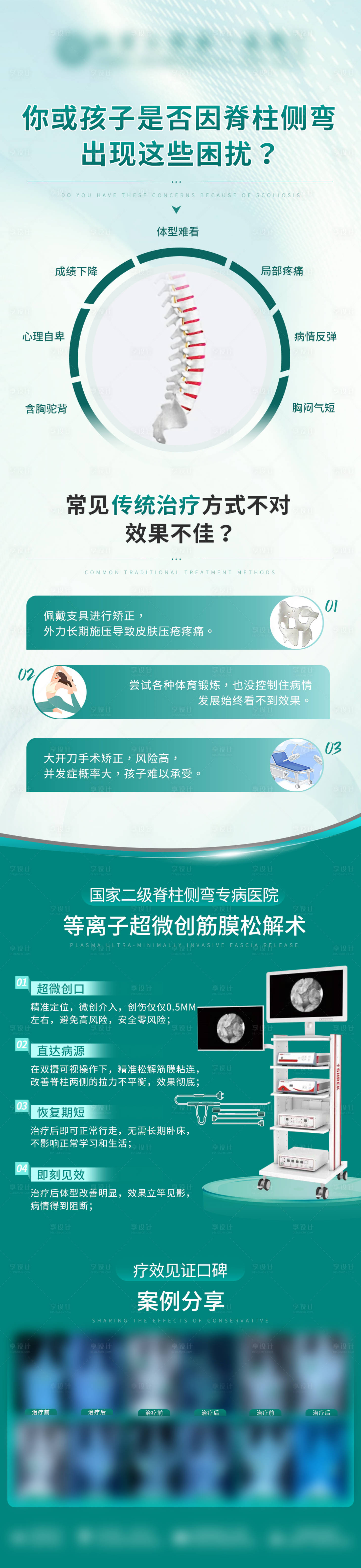 源文件下载【医疗侧弯矫正 】编号：82840029190081151