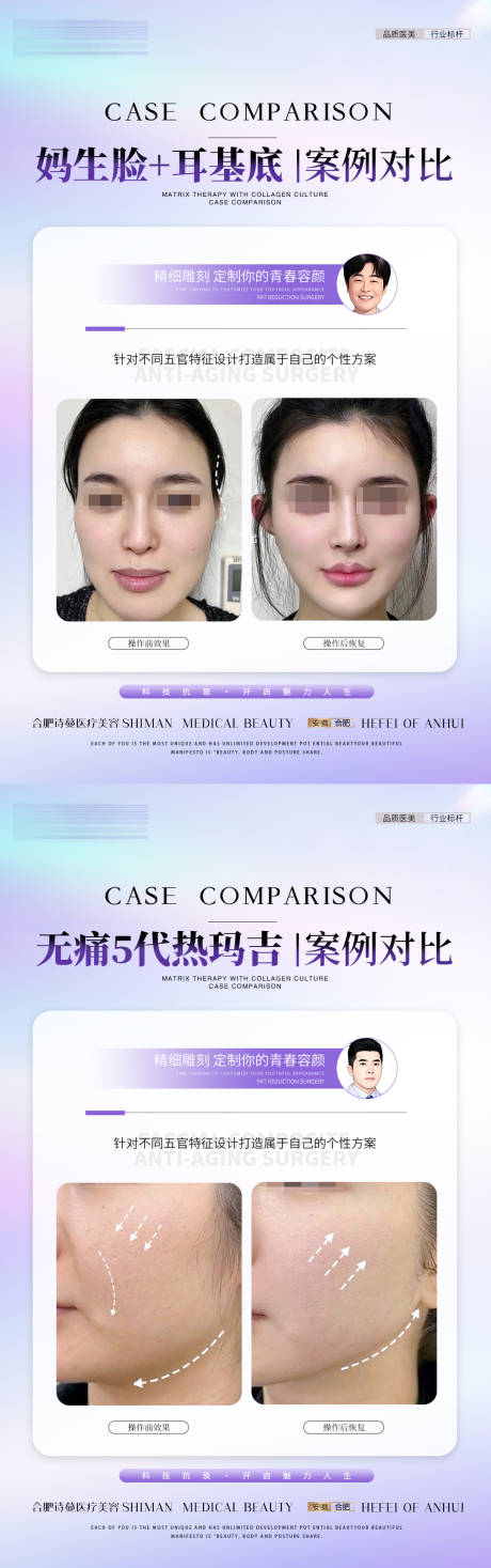 医美紫色案例