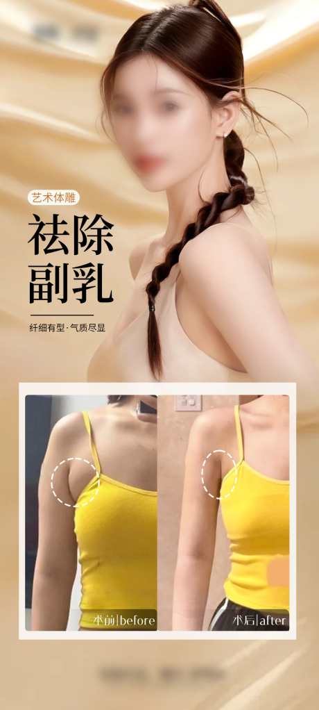 源文件下载【医美祛除副乳案例海报】编号：88190029300586898