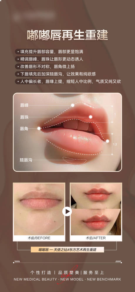 医美嘟嘟唇案例对比