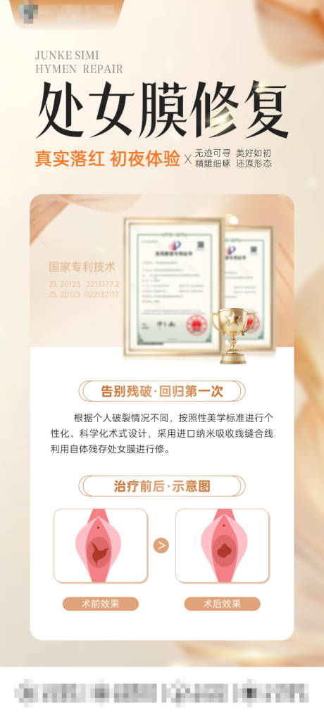 源文件下载【处女膜修复】编号：31050029319753356