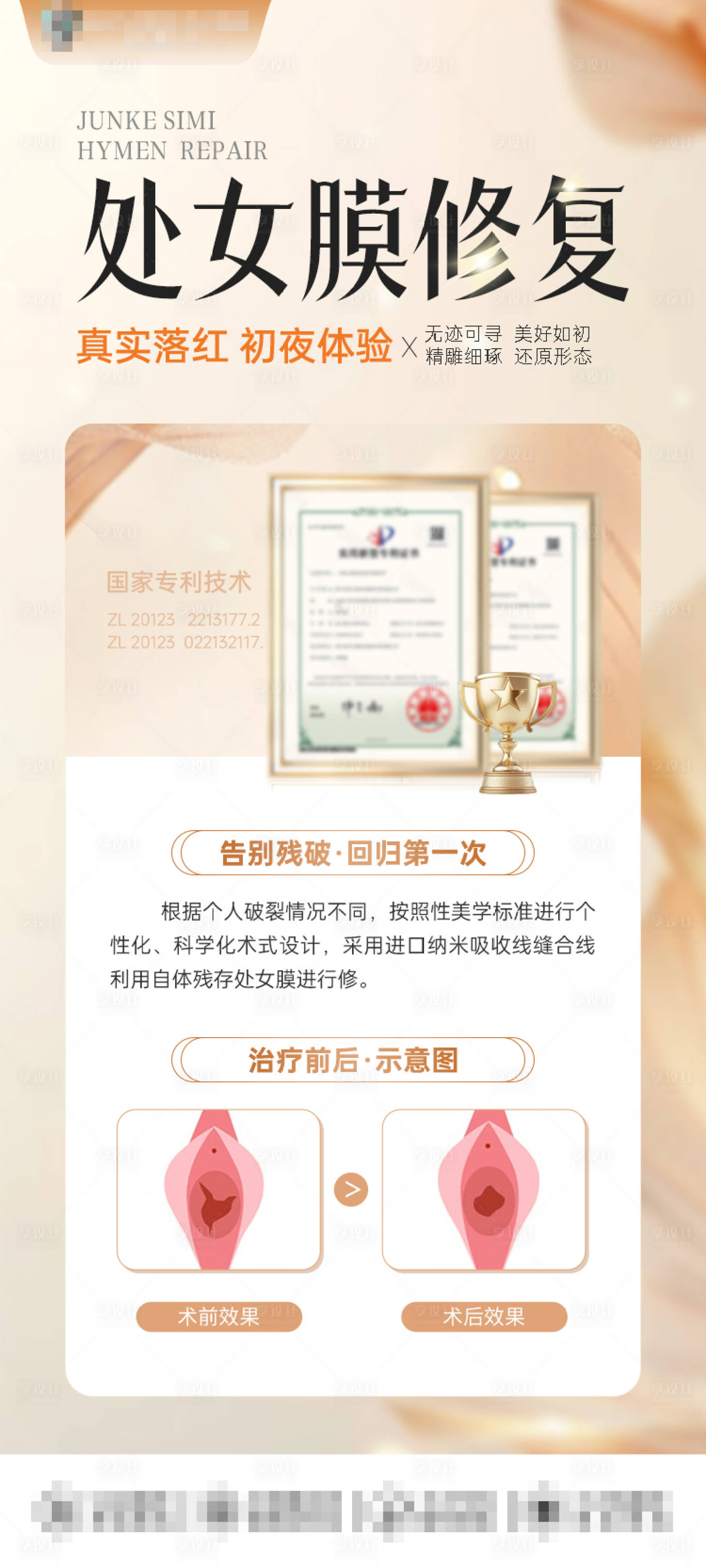 源文件下載【享設計】搜索編號：31050029319753356【處女膜修復】