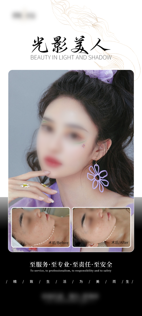 源文件下载【医美V脸案例海报】编号：86680029299775346