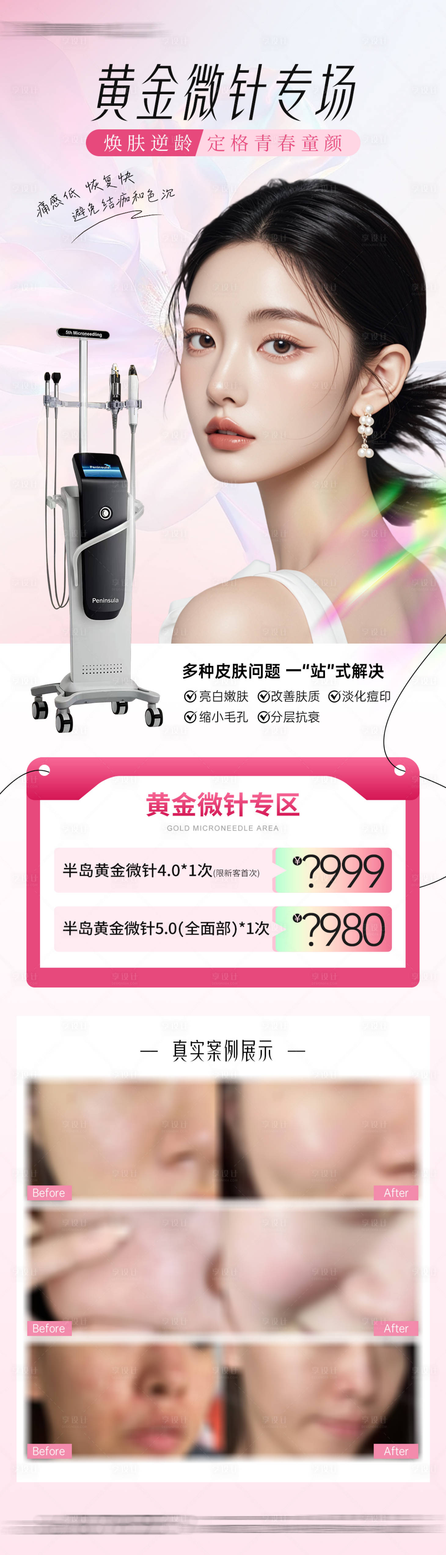 源文件下载【享设计】搜索编号：92100029711373550【医美黄金微针项目案例海报】