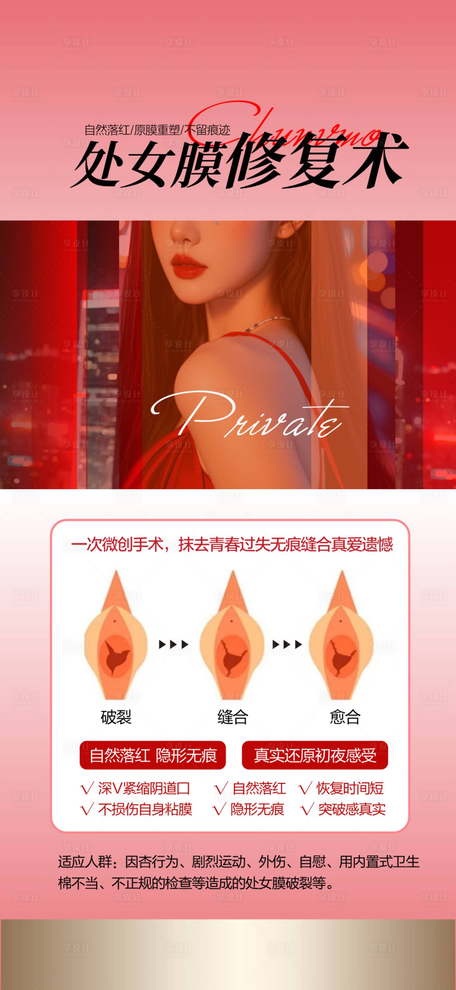 源文件下載【享設計】搜索編號：92230029656139310【醫美處女膜修復海報】