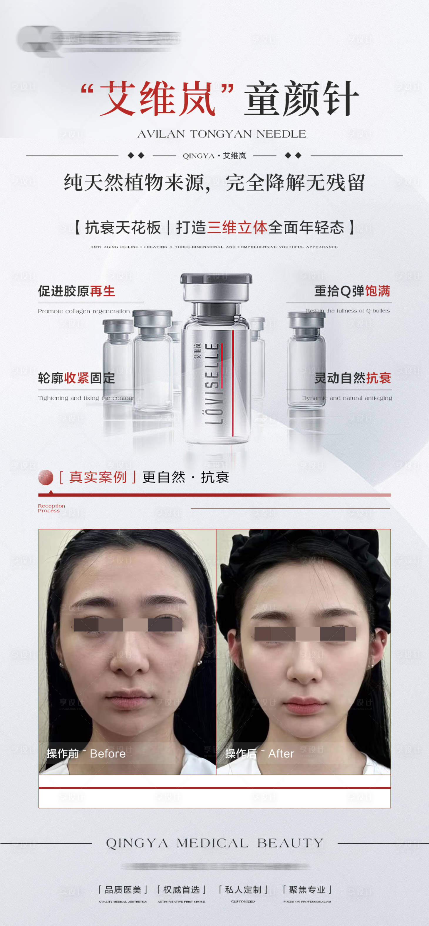 源文件下載【享設計】搜索編號：70950029475953492【艾維嵐童顏針海報】