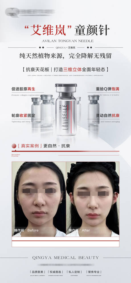 艾维岚童颜针海报