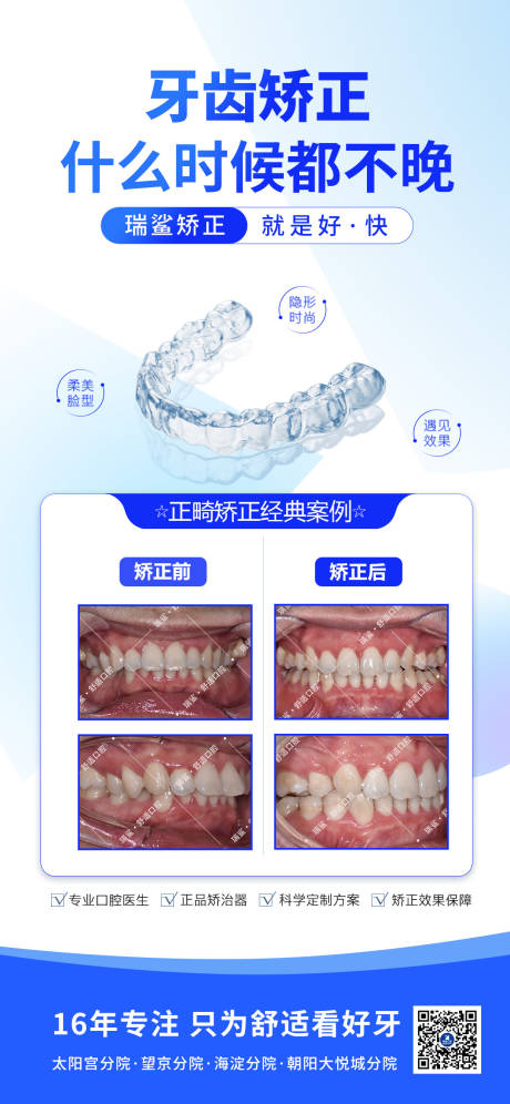 源文件下载【牙齿矫正案例】编号：13080029567587436