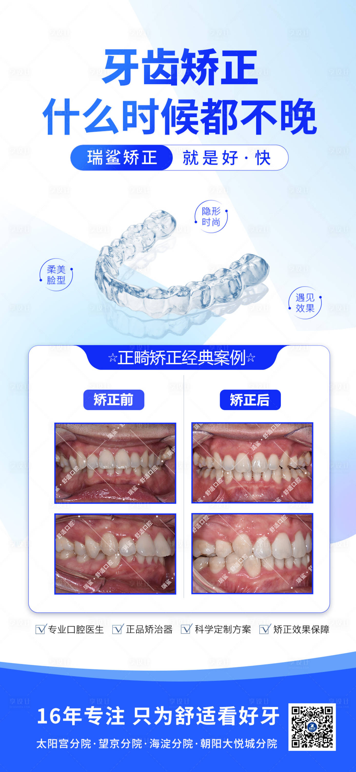 源文件下載【享設計】搜索編號：13080029567587436【牙齒矯正案例】