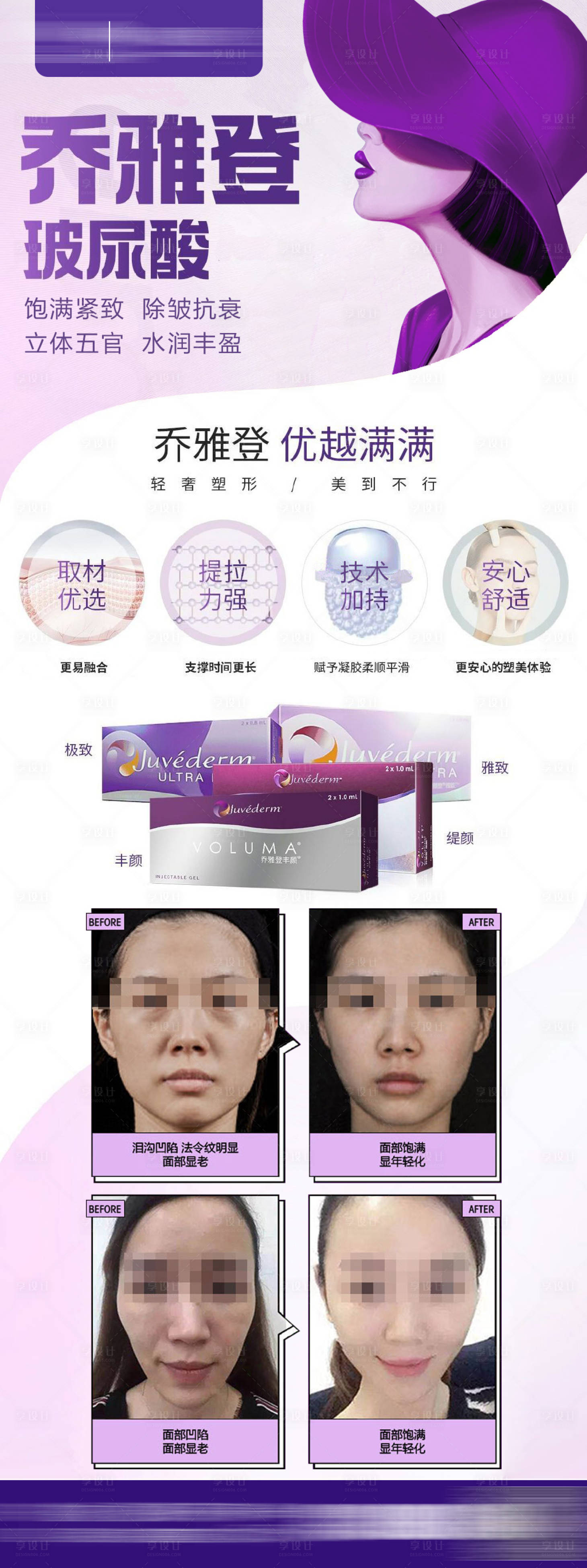 源文件下载【乔雅登案例海报微图】编号：25340029760426151