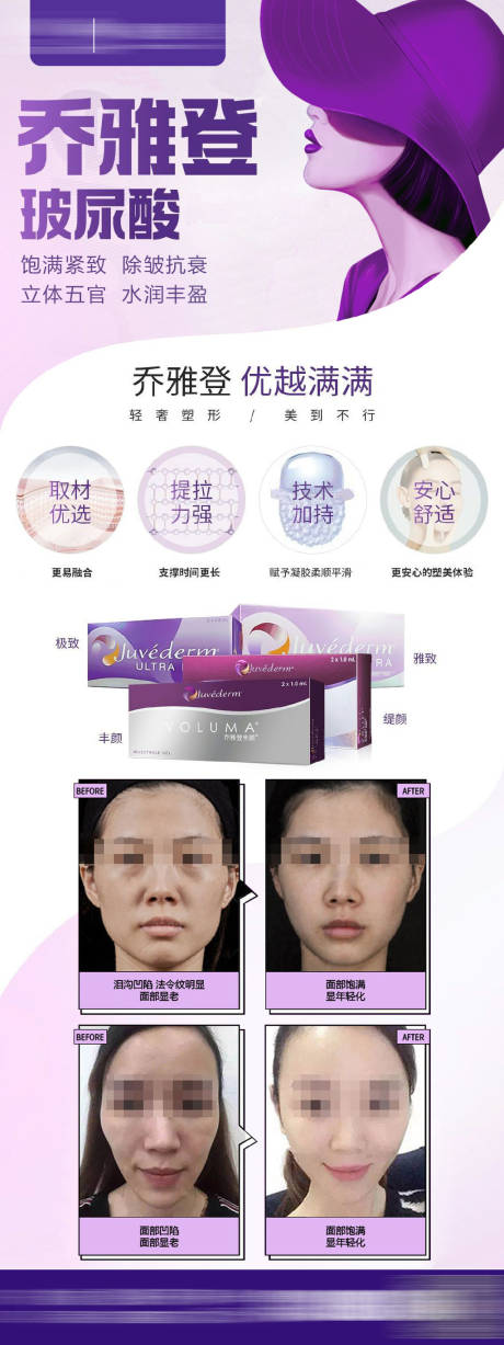乔雅登案例海报微图