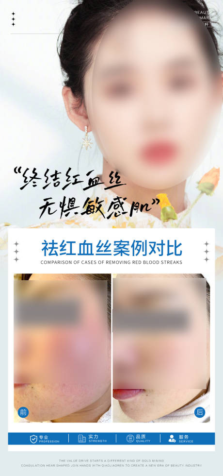 源文件下載【紅血絲案例對比海報】編號：69630028197287392