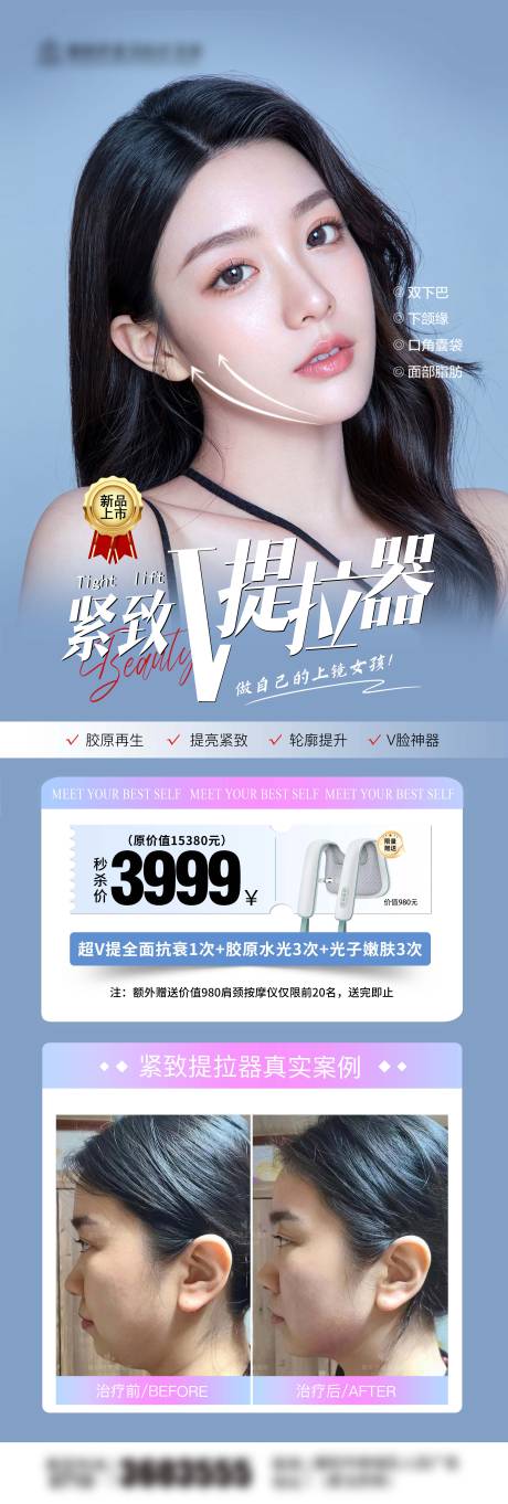 源文件下载【医美小v脸海报】编号：90420029423879162