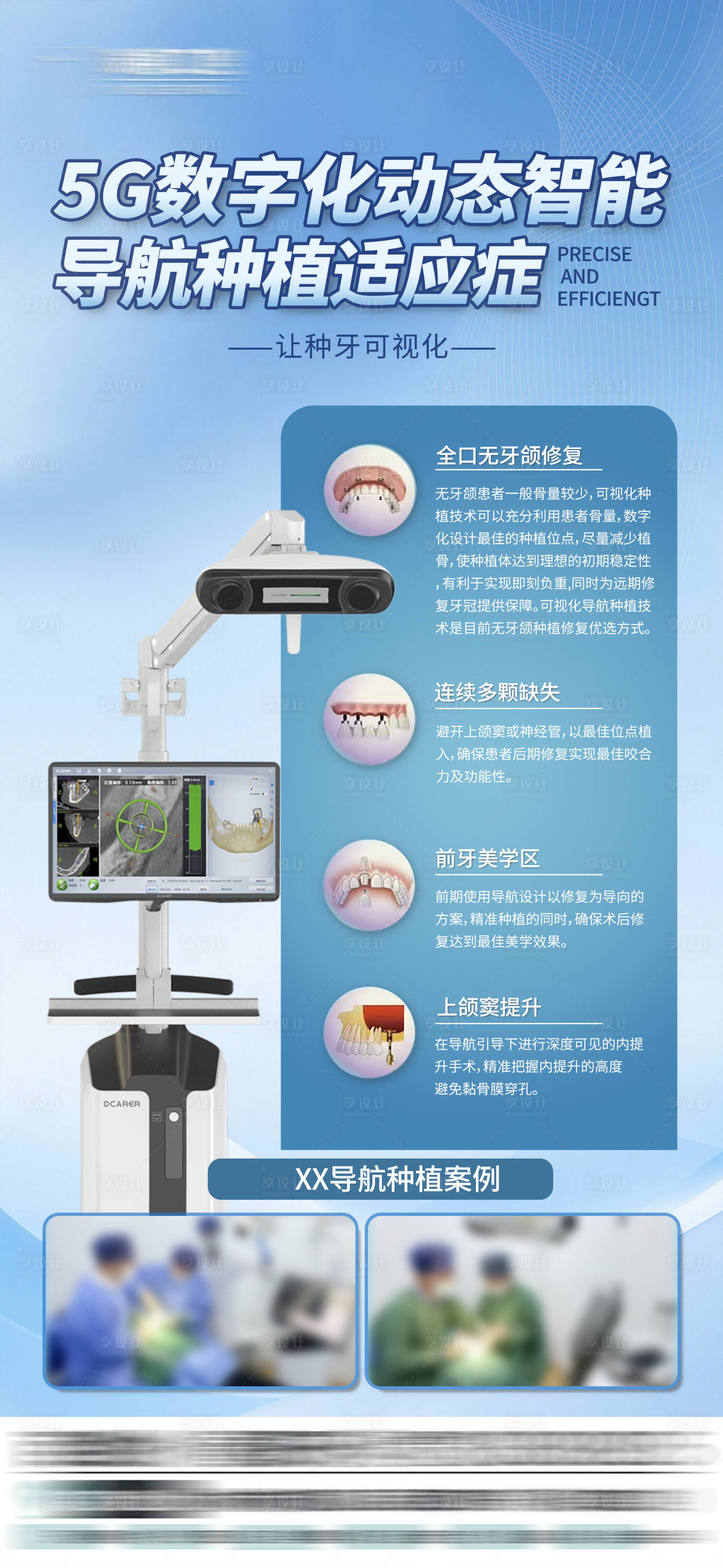 源文件下载【享设计】搜索编号：21390029696027901【导航种植牙案例宣传海报 】