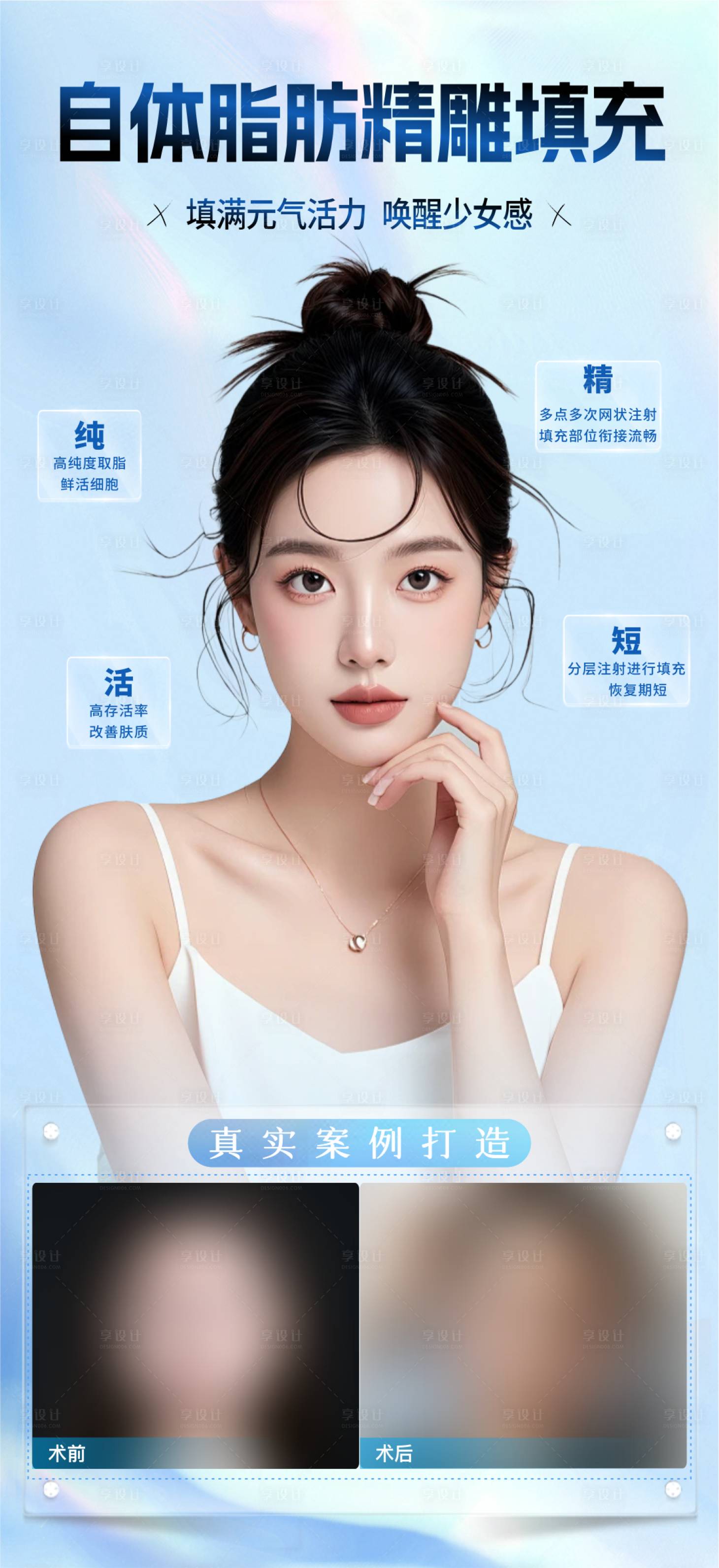 源文件下載【享設計】搜索編號：34740029217297120【脂肪填充】