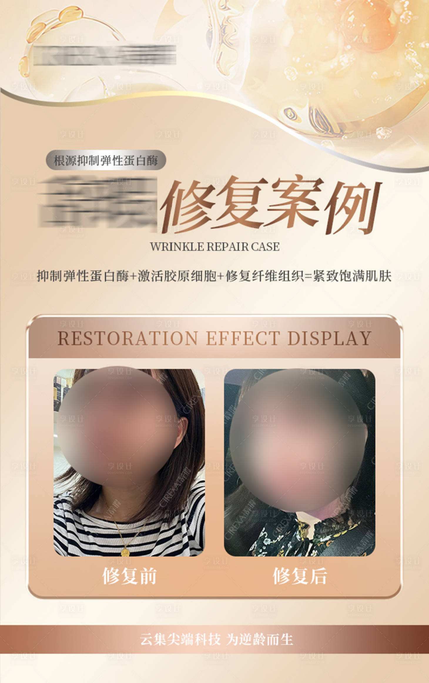 源文件下載【享設計】搜索編號：43450029830665234【修復對比圖宣傳海報】