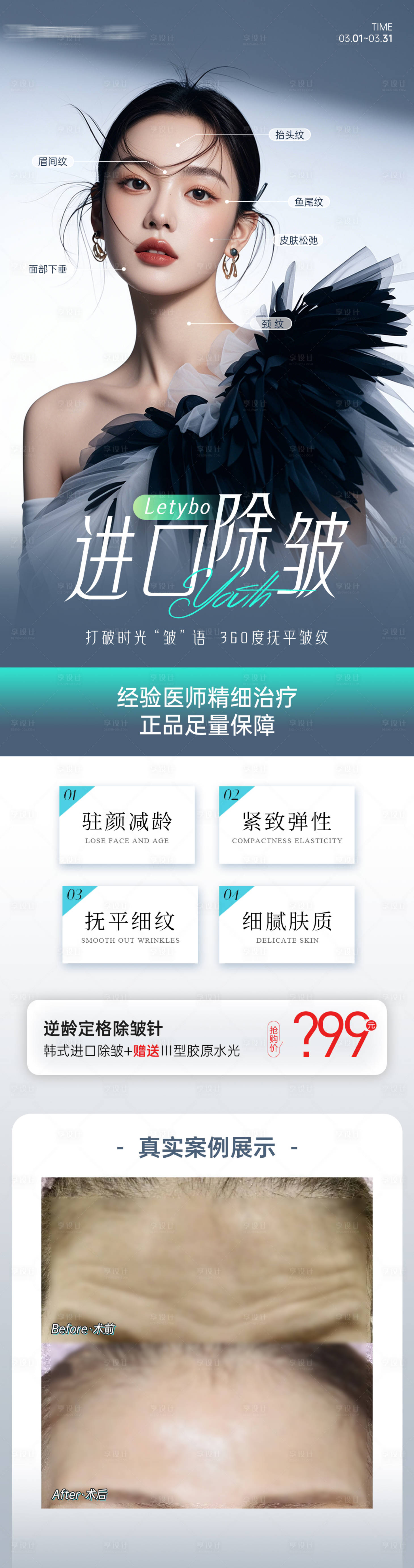 源文件下載【醫(yī)美韓國進(jìn)口除皺項目案例長圖】編號：80650029831296255
