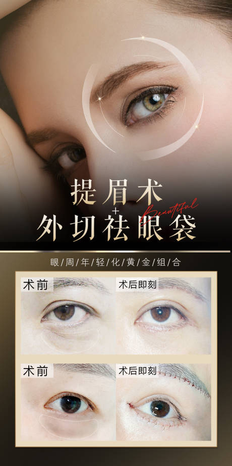 源文件下载【提眉祛眼袋医美案例】编号：36220029818294670