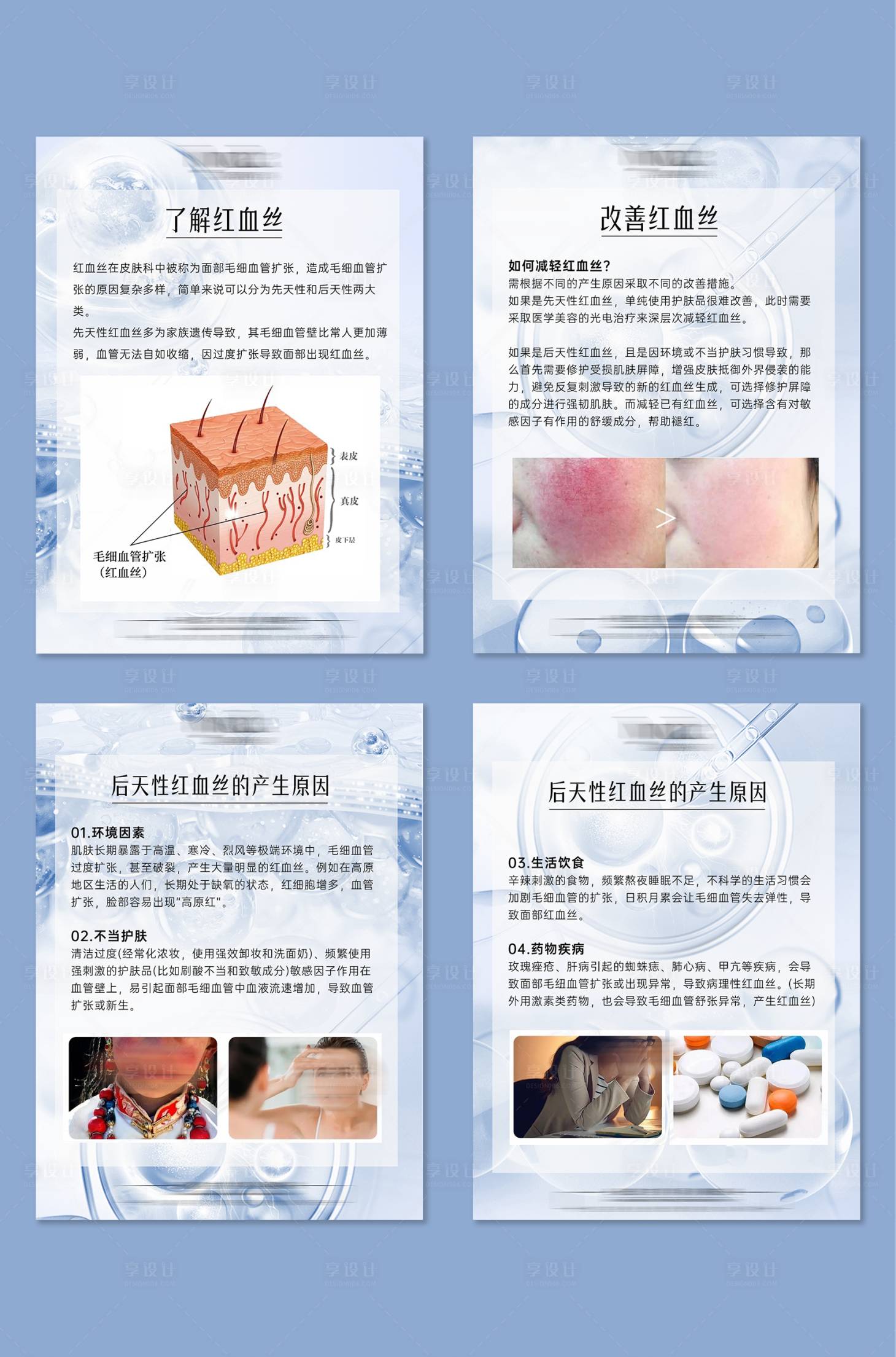 源文件下载【享设计】搜索编号：47630029345107291【春季敏感了解红血丝小知识系列海报】