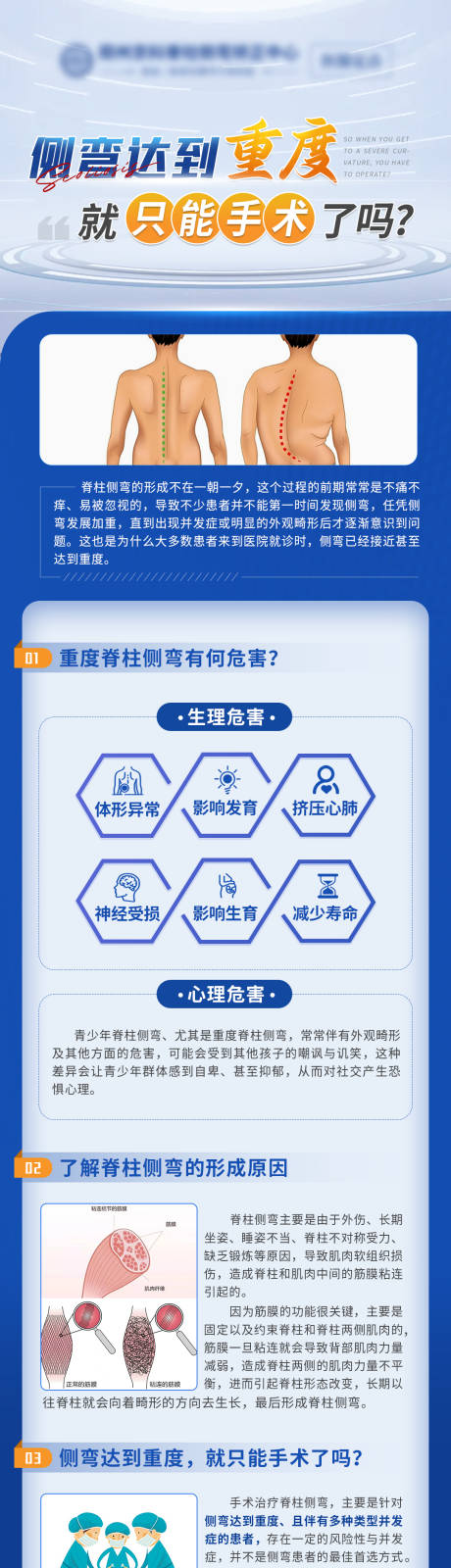 源文件下载【重度侧弯科普 】编号：24080029381821664