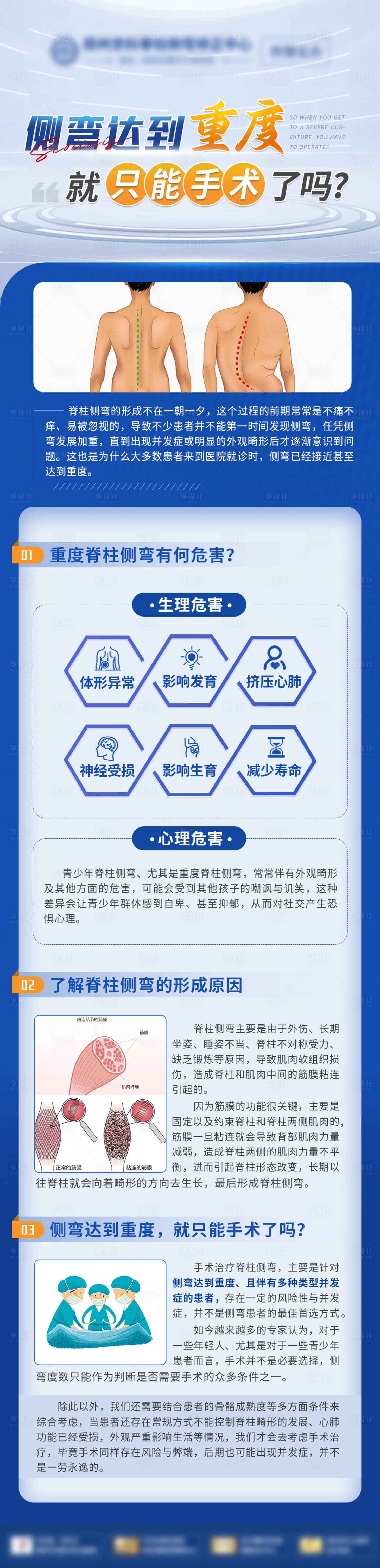 源文件下載【享設計】搜索編號：24080029381821664【重度側彎科普 】