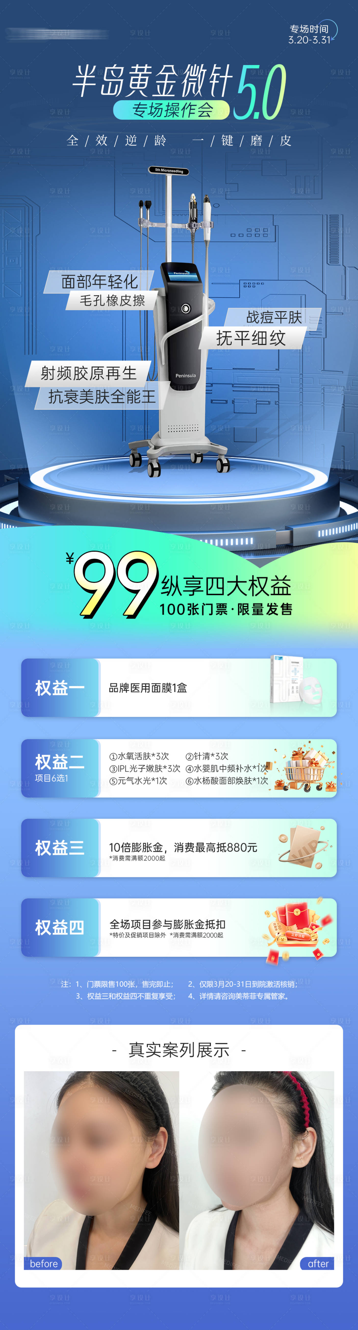 源文件下載【享設(shè)計(jì)】搜索編號(hào)：38060029729814003【醫(yī)美黃金微針福利案列長(zhǎng)圖】