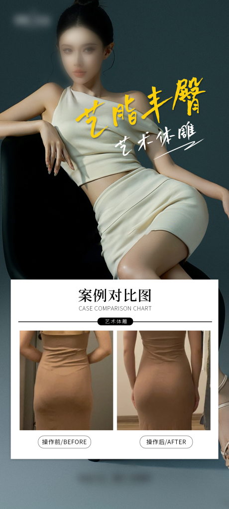 源文件下載【享設(shè)計(jì)】搜索編號(hào)：30720029675071227【醫(yī)美豐臀案例海報(bào)】