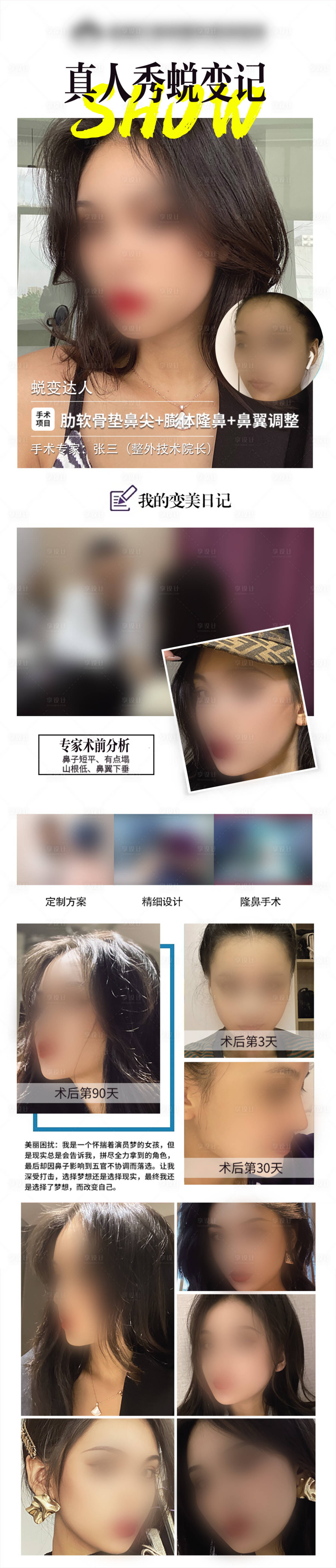源文件下載【醫(yī)美蛻變季活動長圖】編號：57340029426937844