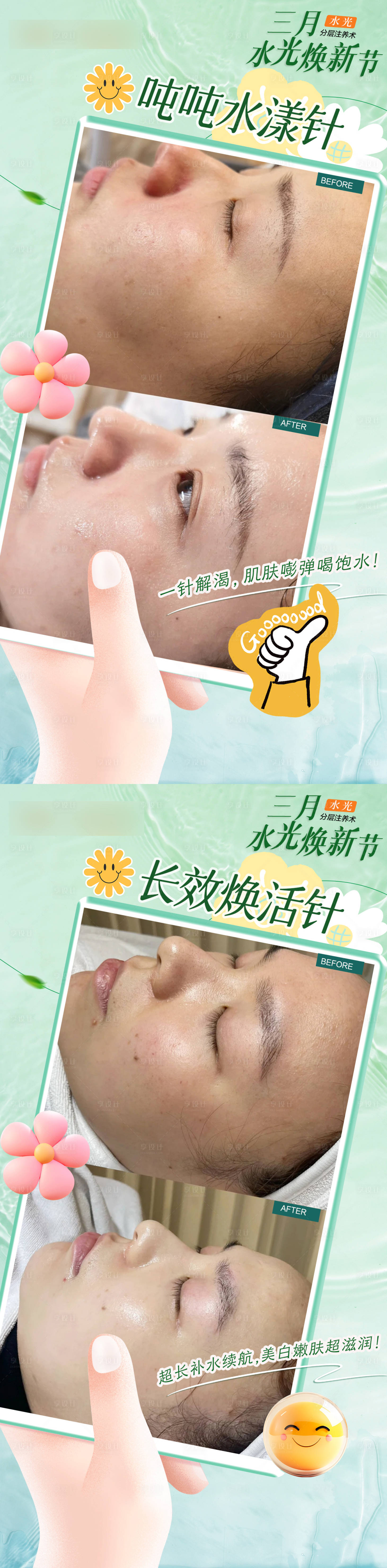 源文件下載【享設計】搜索編號：75250029147277580【醫美水光煥新季海報】