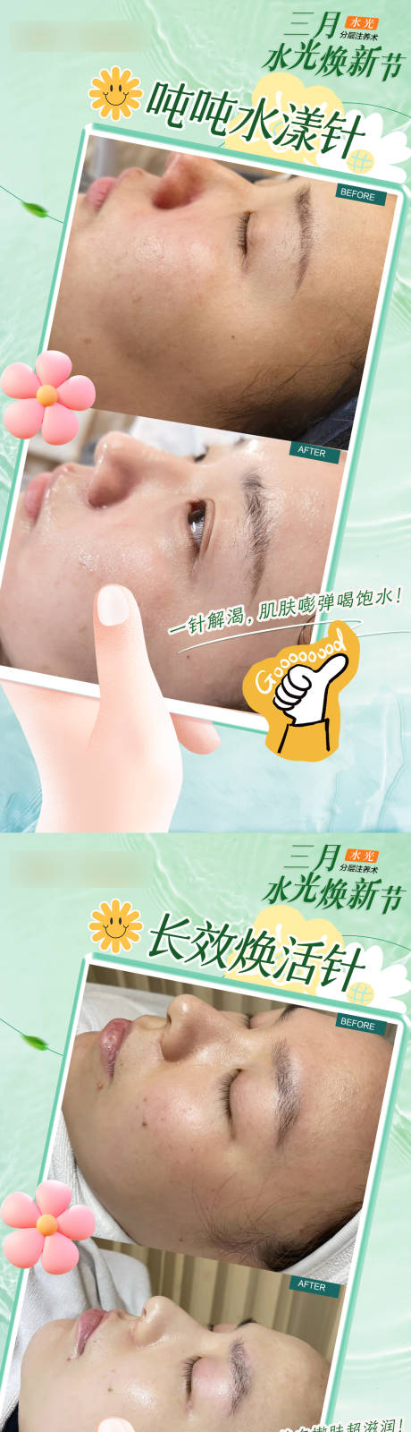 医美水光焕新季海报