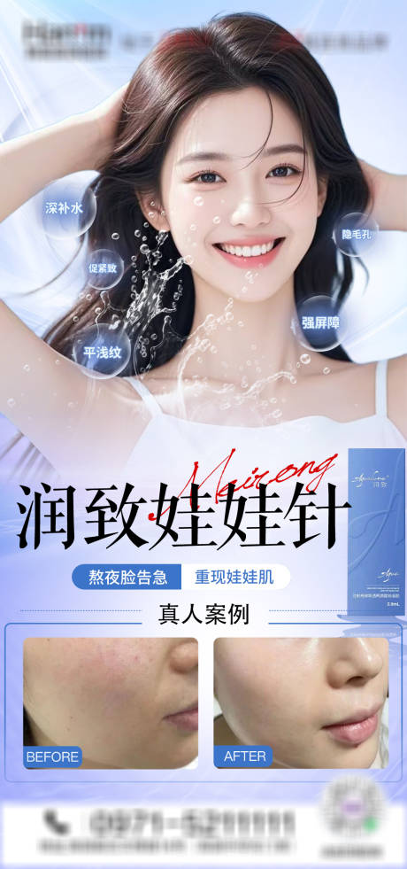 医美润致娃娃针海报
