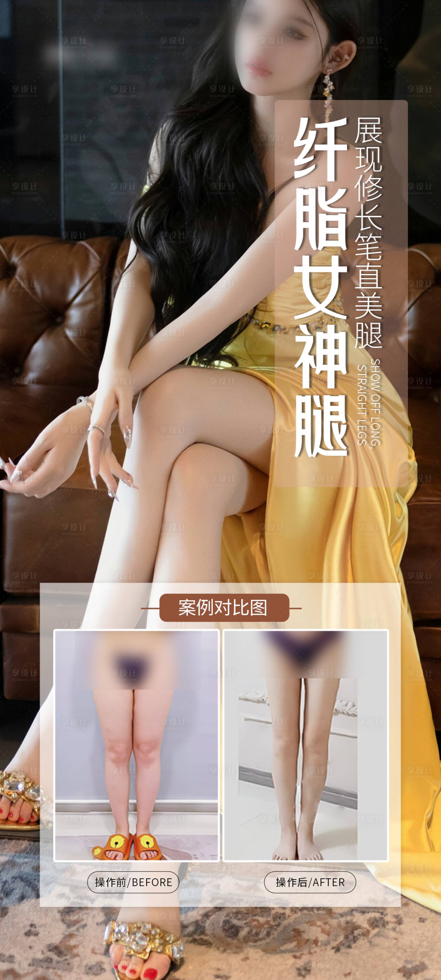 源文件下載【享設計】搜索編號：41610029491712316【醫美細腿案例海報】