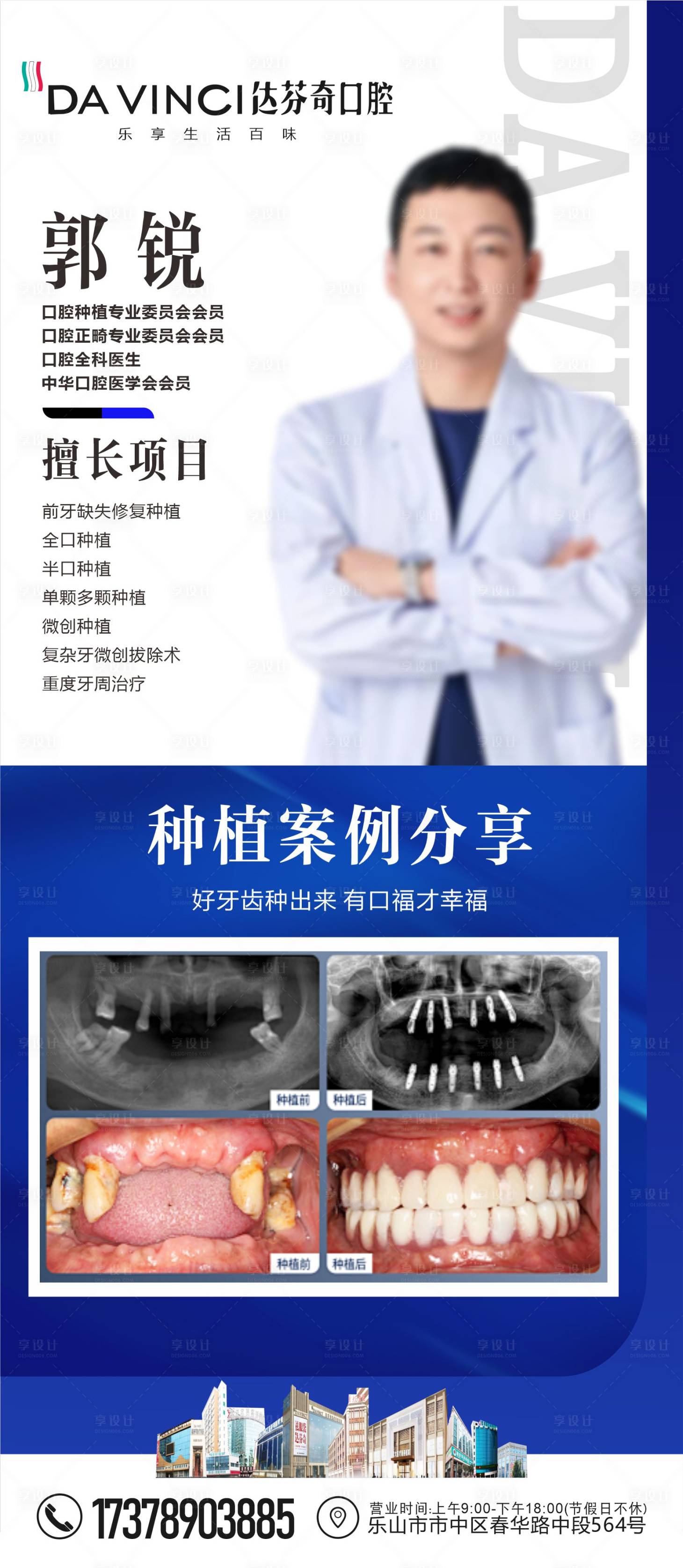 源文件下载【享设计】搜索编号：82880029810819244【口腔医生专家介绍种植案例海报】
