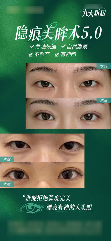 源文件下載【享設計】搜索編號：20120029317971849【雙眼皮案例海報】