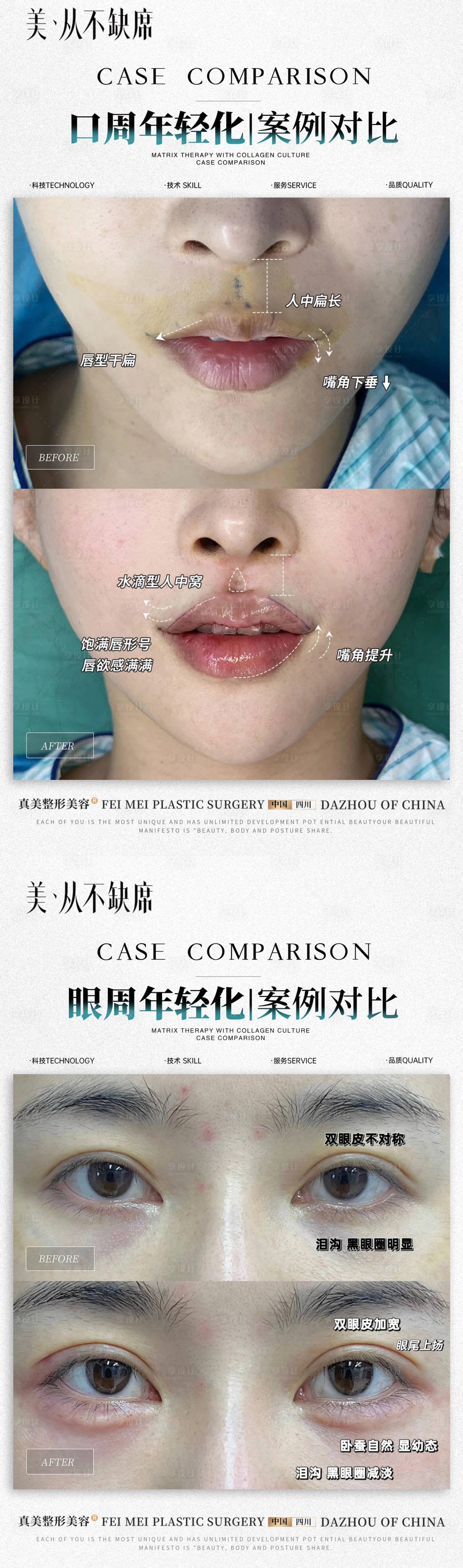 源文件下载【医美口周眼周年轻化案例】编号：23960029844381773