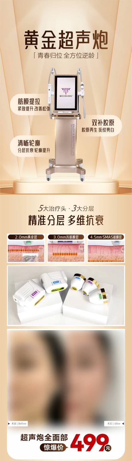 源文件下载【黄金超声炮医美长图】编号：44310029661645402