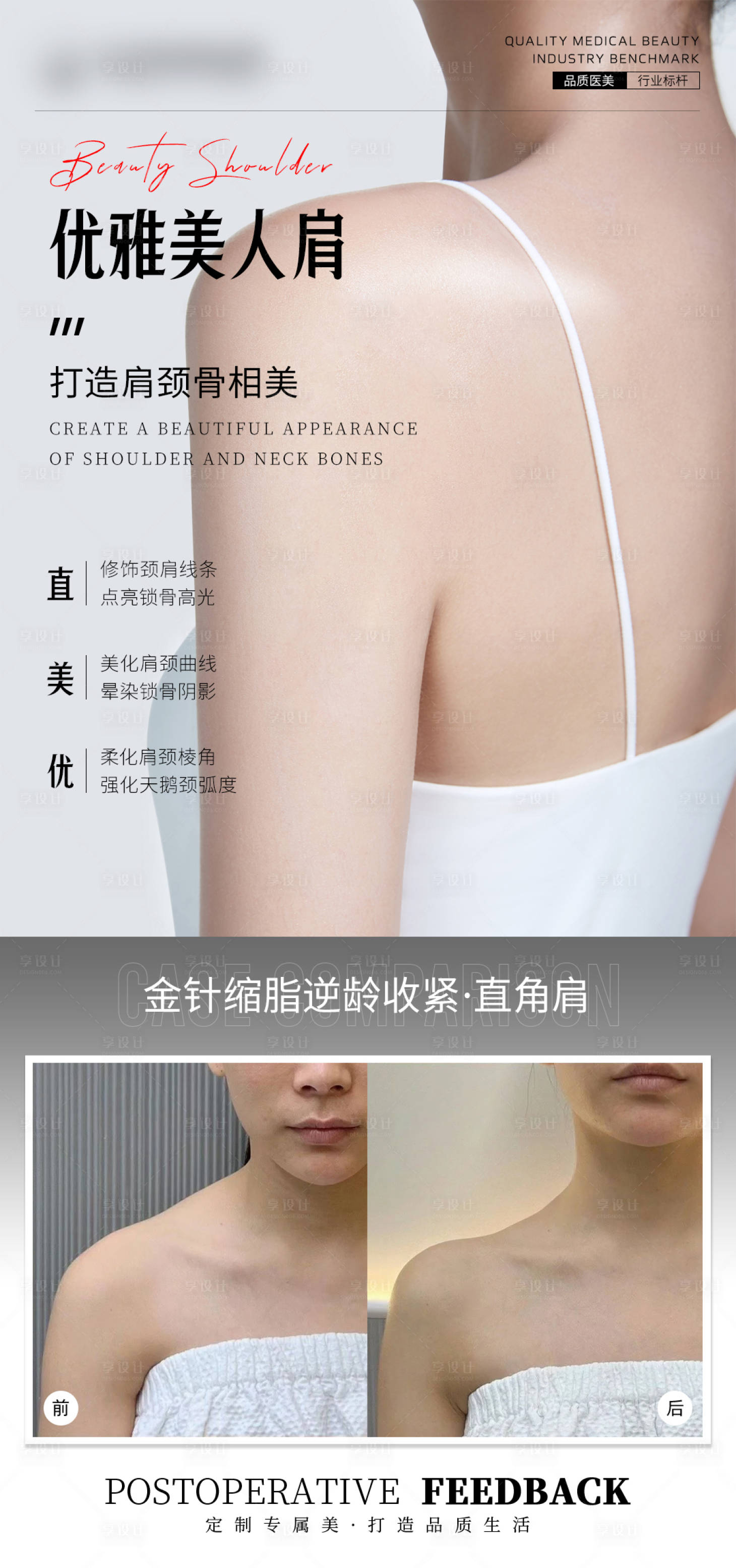源文件下载【医美案例美人肩海报】编号：94990029639896015