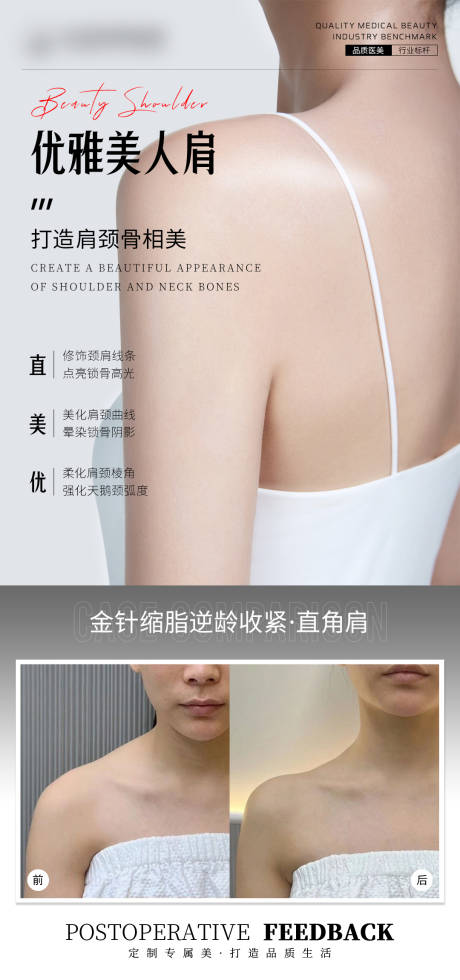 医美案例美人肩海报