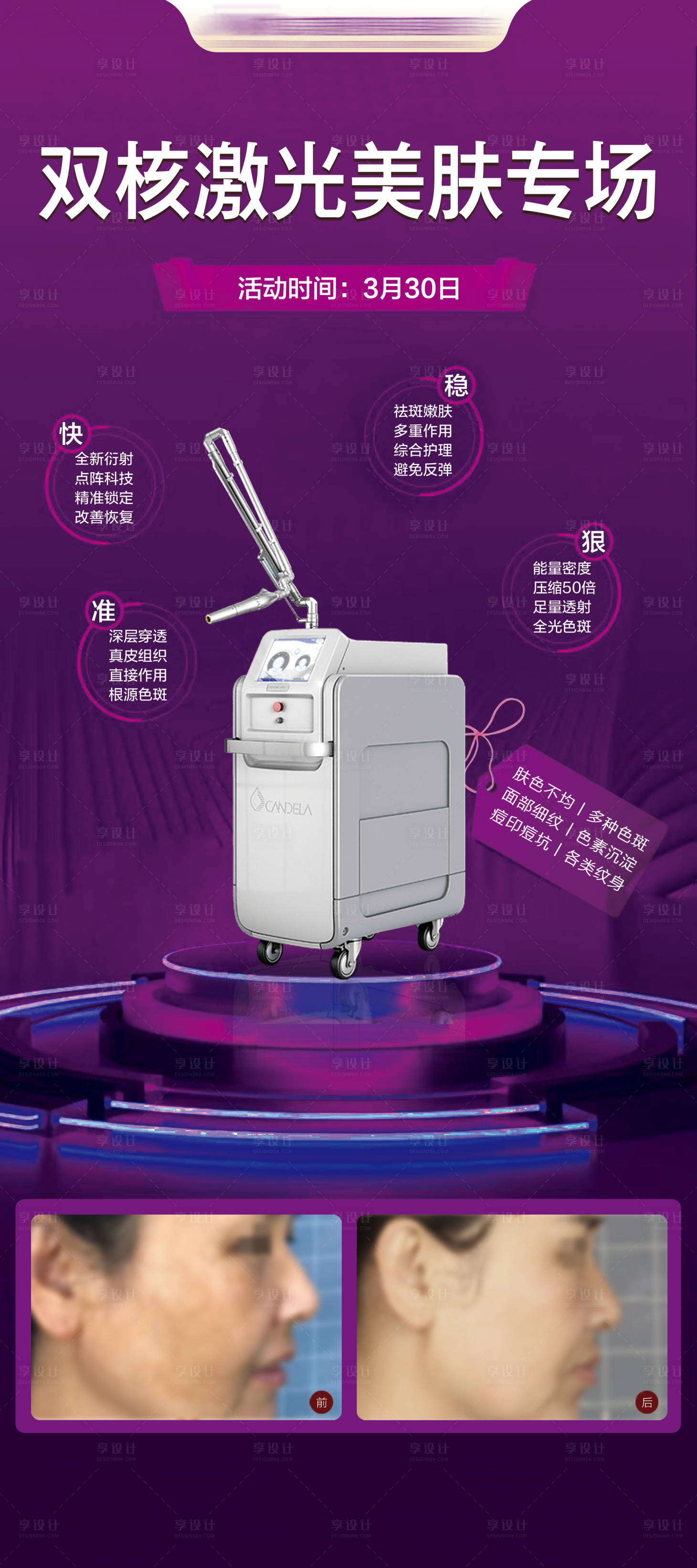 源文件下载【医美超皮秒案例展架】编号：64810029572074804