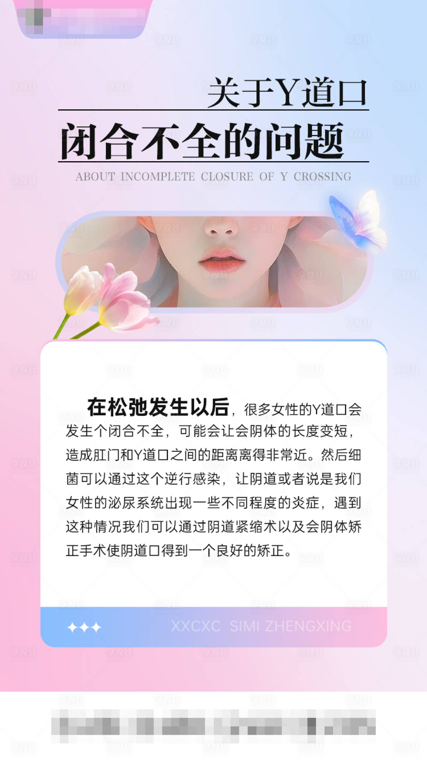 源文件下载【关于Y道口闭合不全的问题0215】编号：91010029319966730