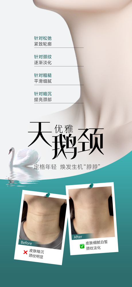 源文件下载【天鹅颈】编号：22510029743005114