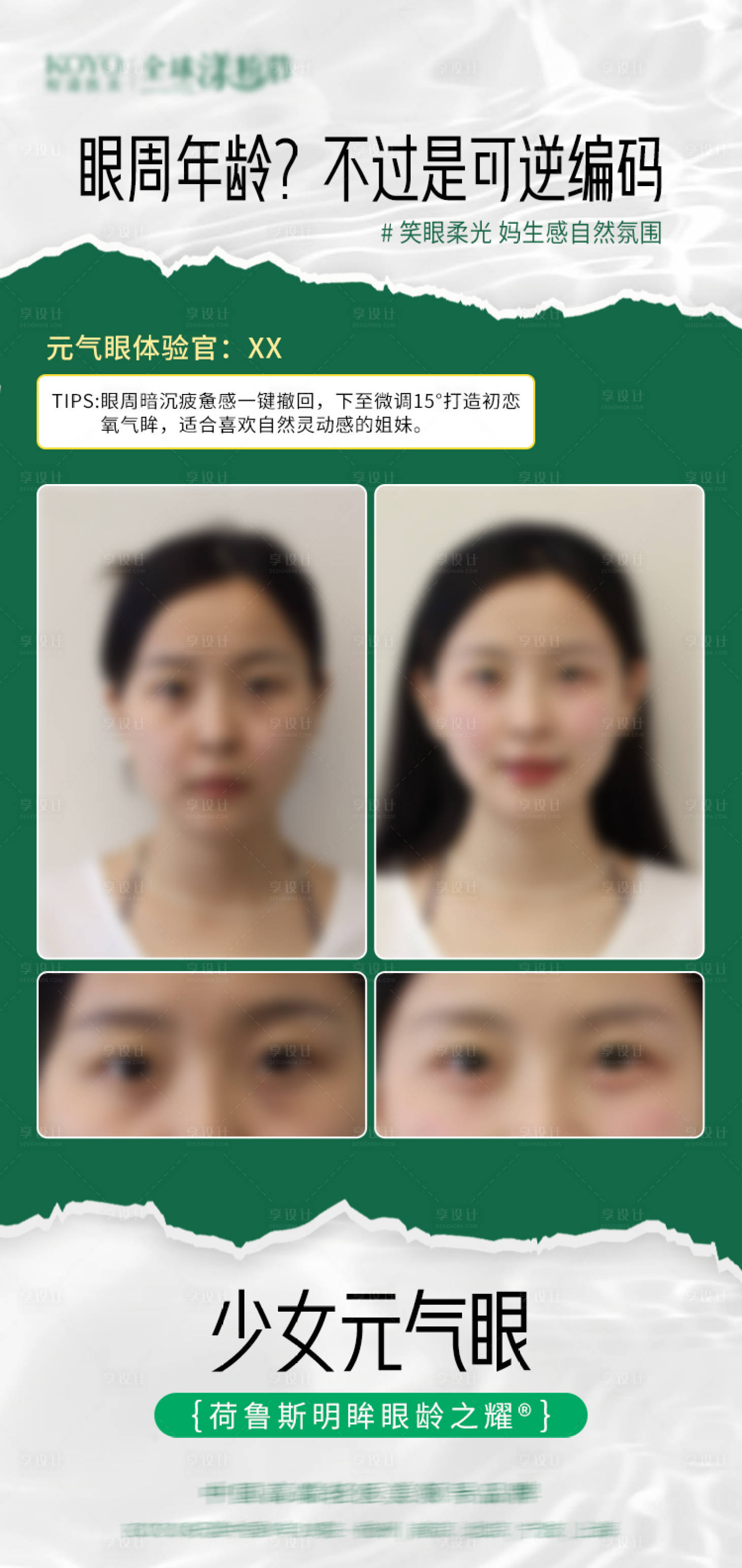 源文件下載【享設計】搜索編號：85550029715049859【醫美案例海報】