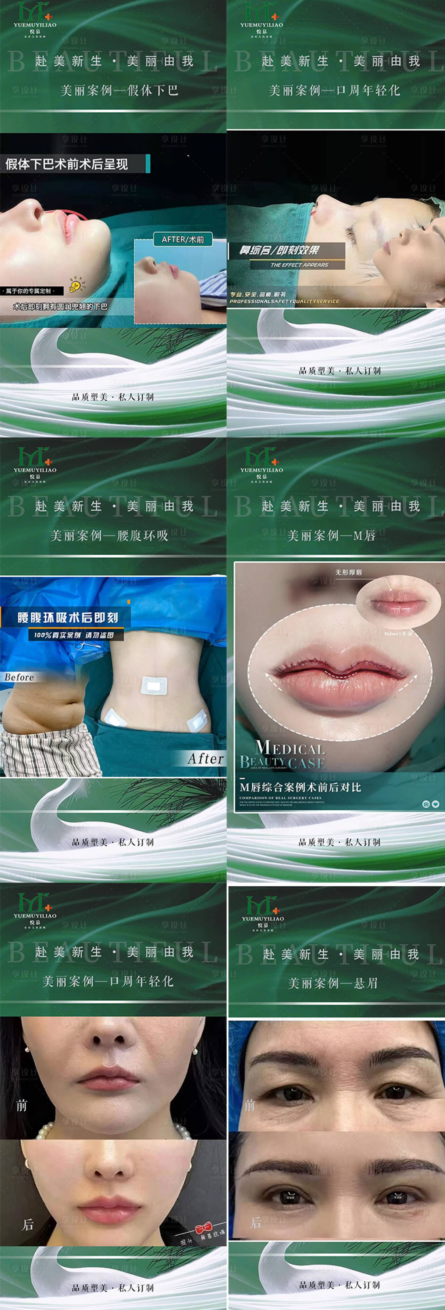 源文件下载【享设计】搜索编号：20270029495707575【眼综合案例海报】