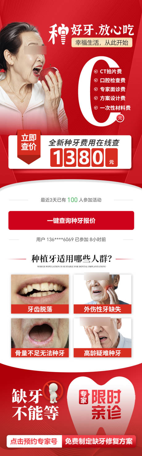 口腔种植牙长图